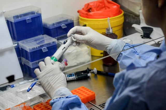 Laboratório de MT recebe 100 kits do MS para diagnóstico da Covid-19